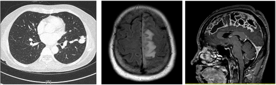 Fig. 2 (abstract P0481).