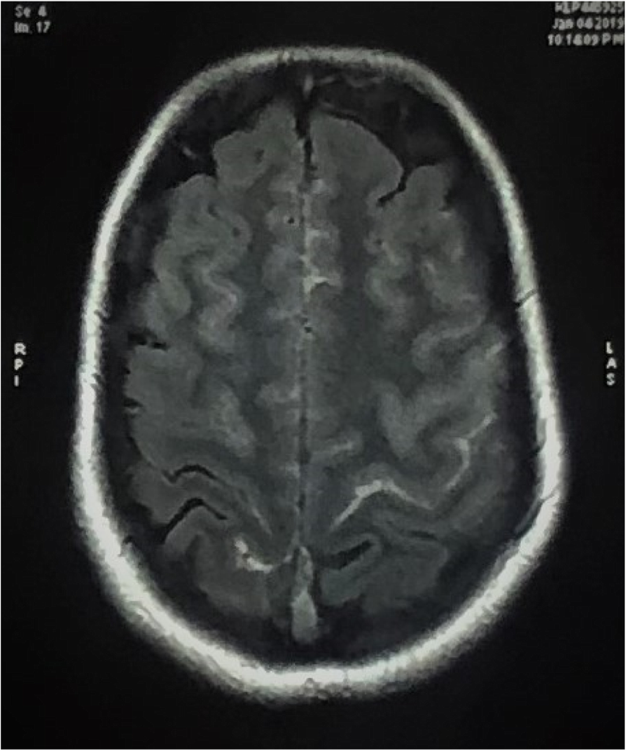 Fig. 1 (abstract P0489). 