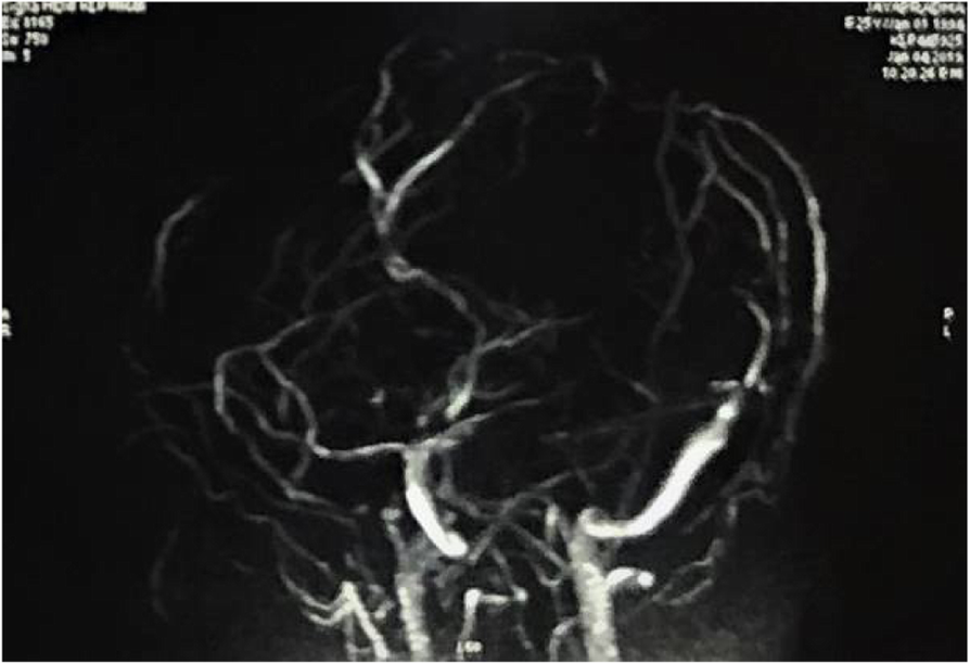 Fig. 2 (abstract P0489). 