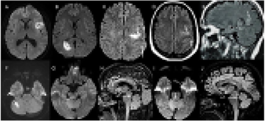 Fig. 1 (abstract P0494).