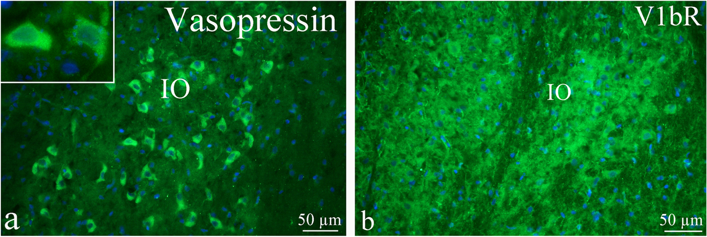 Fig. 12