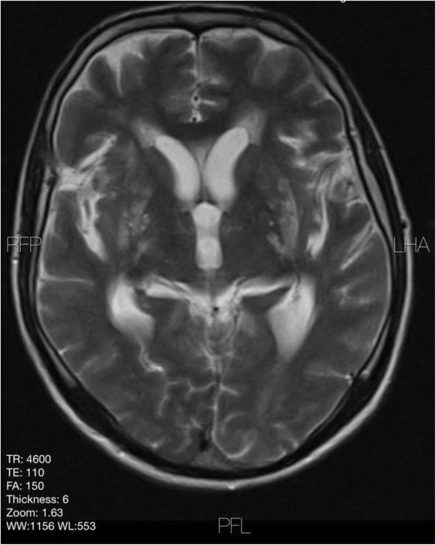 Fig. 1 (abstract P30).