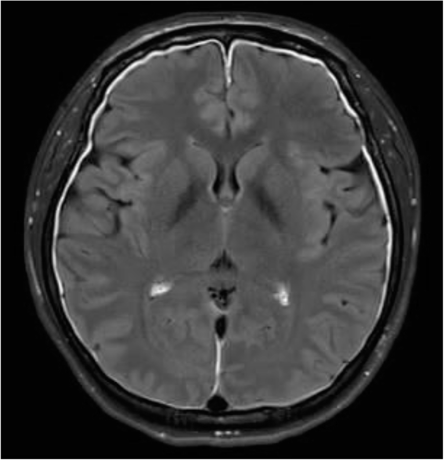 Fig. 1 (abstract P34).