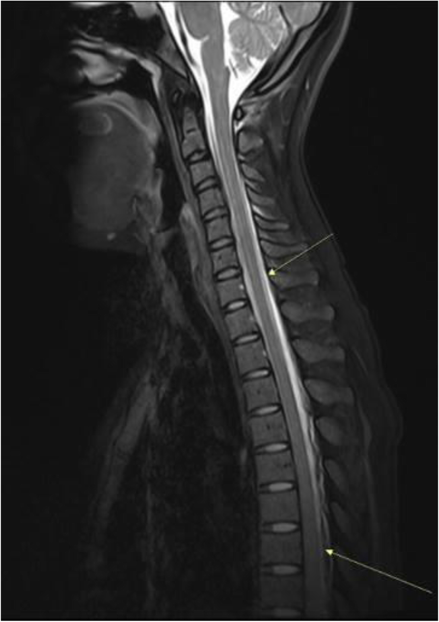 Fig. 2 (abstract P34).