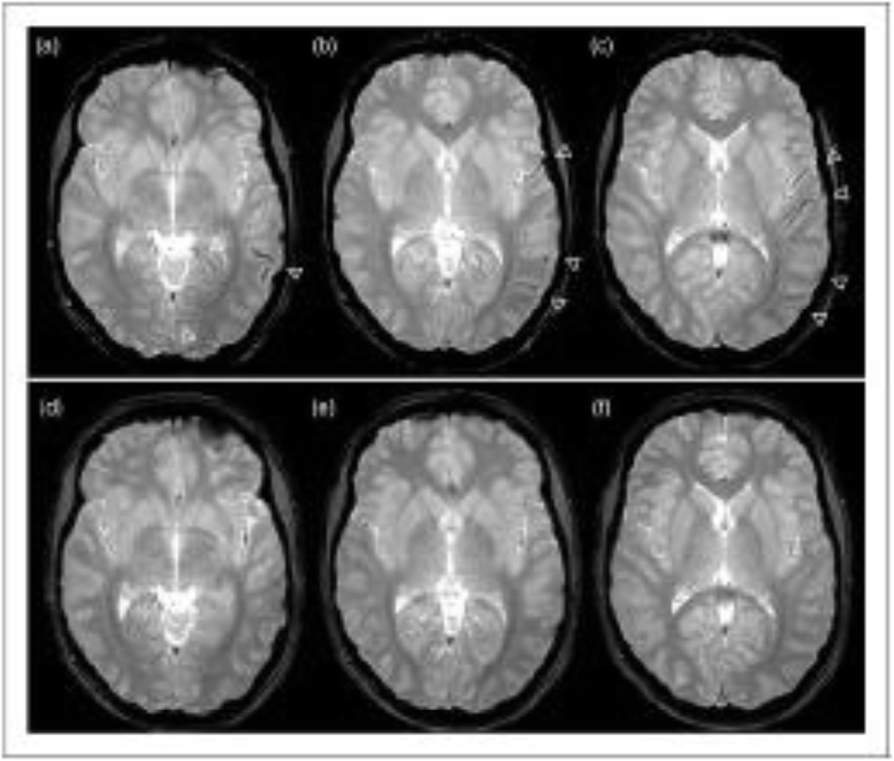 Fig. 1 (abstract P60).