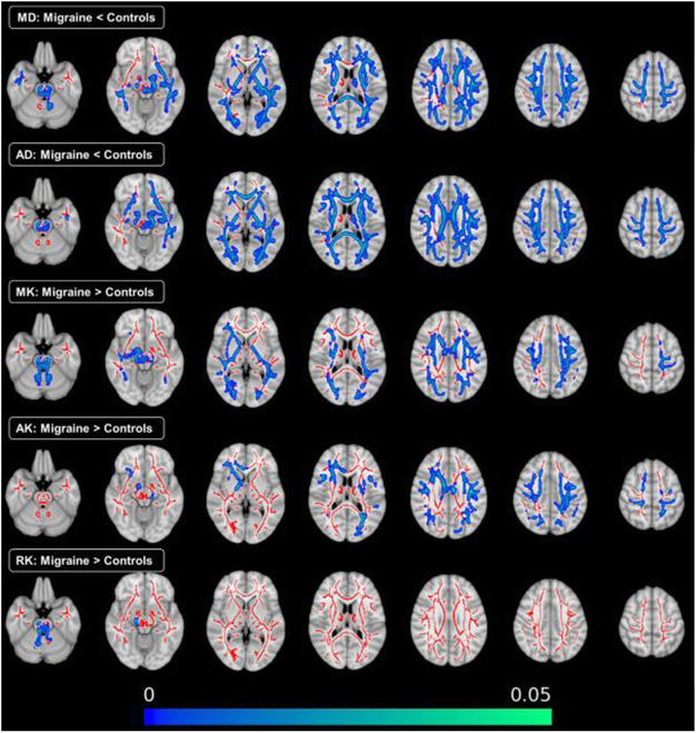 Fig. 1 (abstract P67).