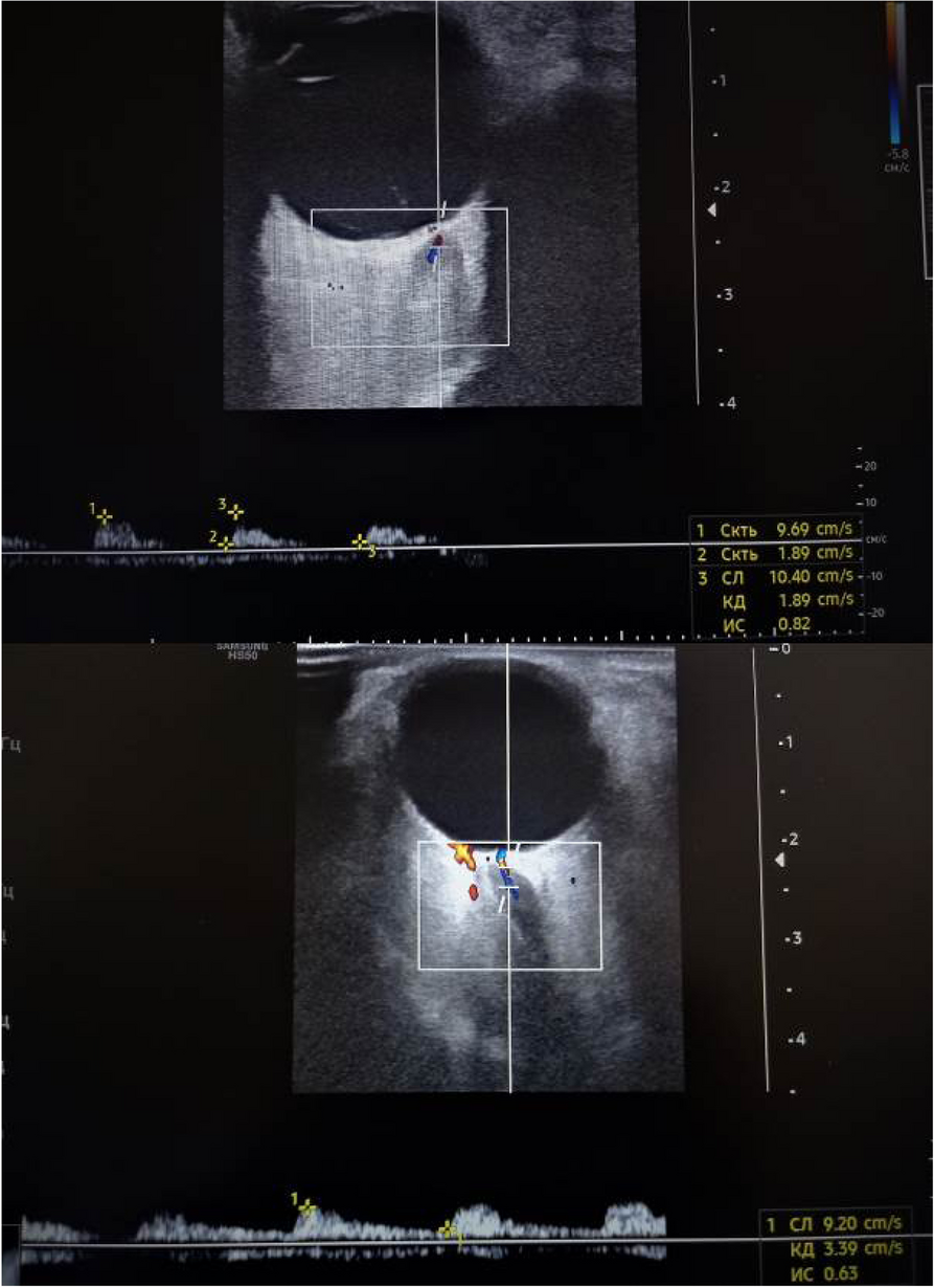 Fig. 1 (Abstract P001)