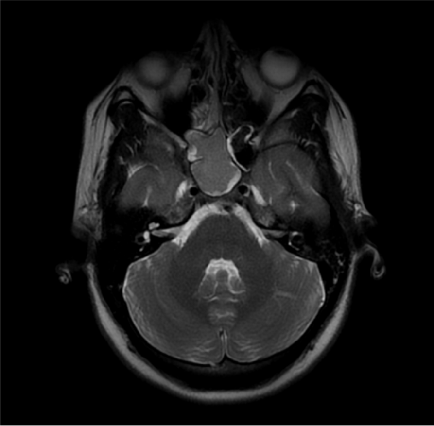 Fig. 1 (Abstract P075)