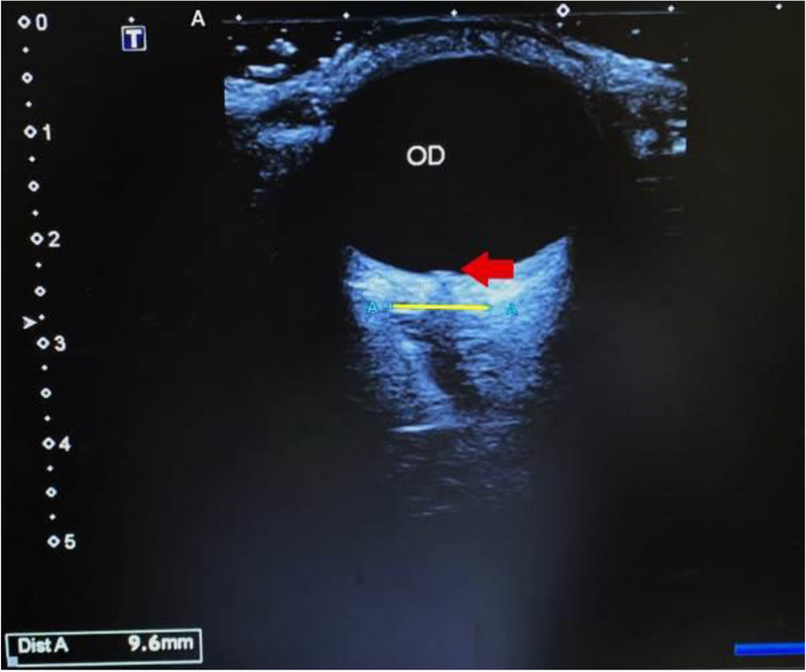 Fig. 2 (Abstract P170)