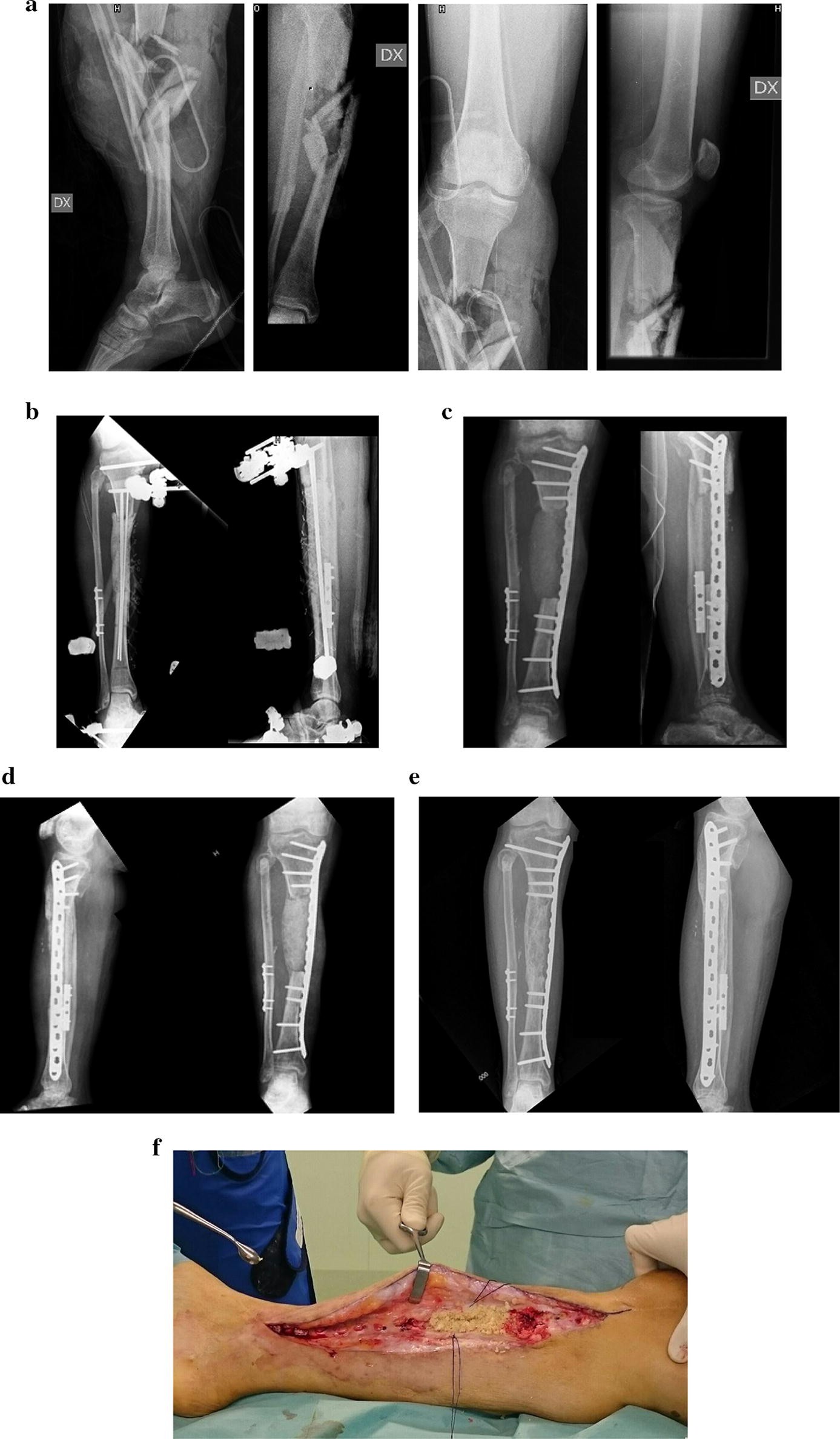 Fig. 2