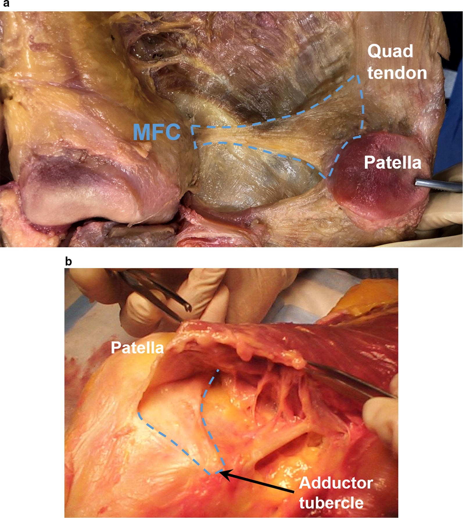 Fig. 3