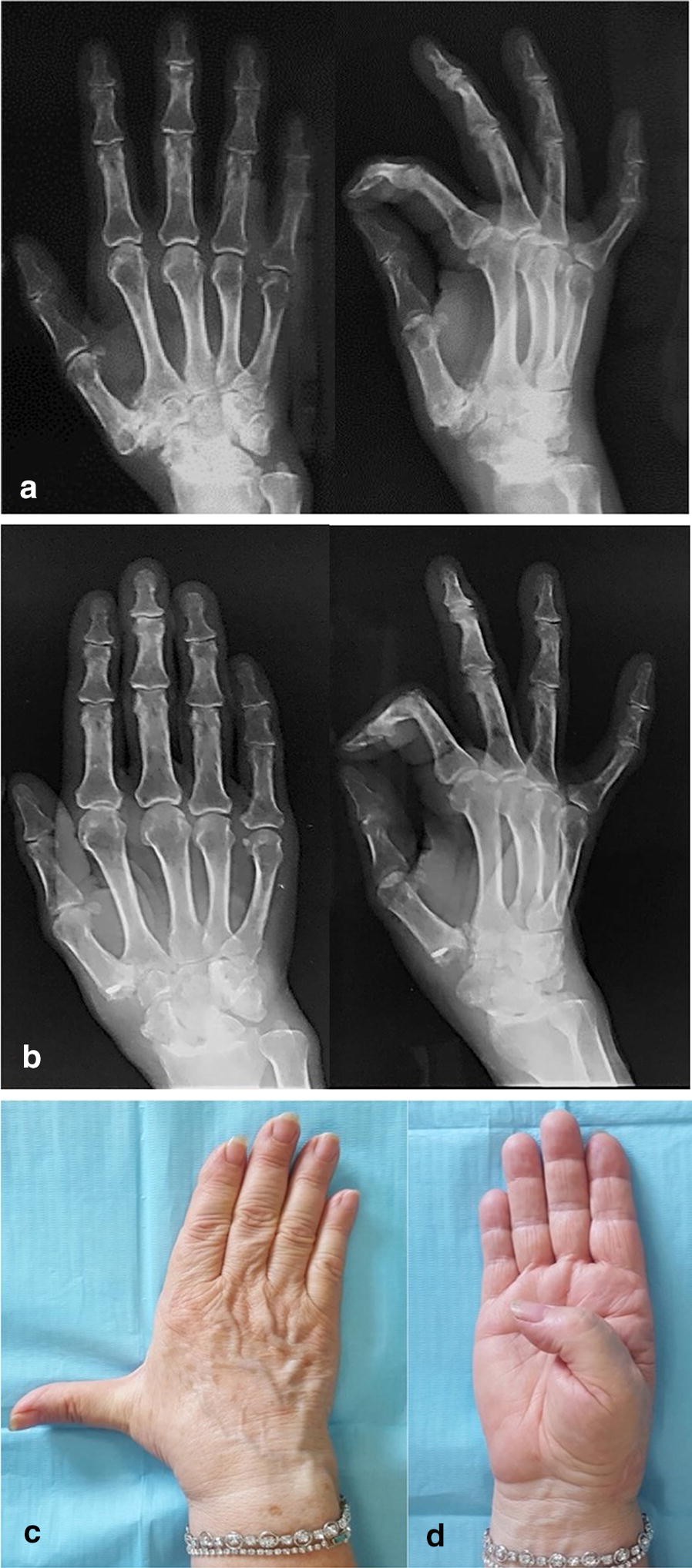 Fig. 2