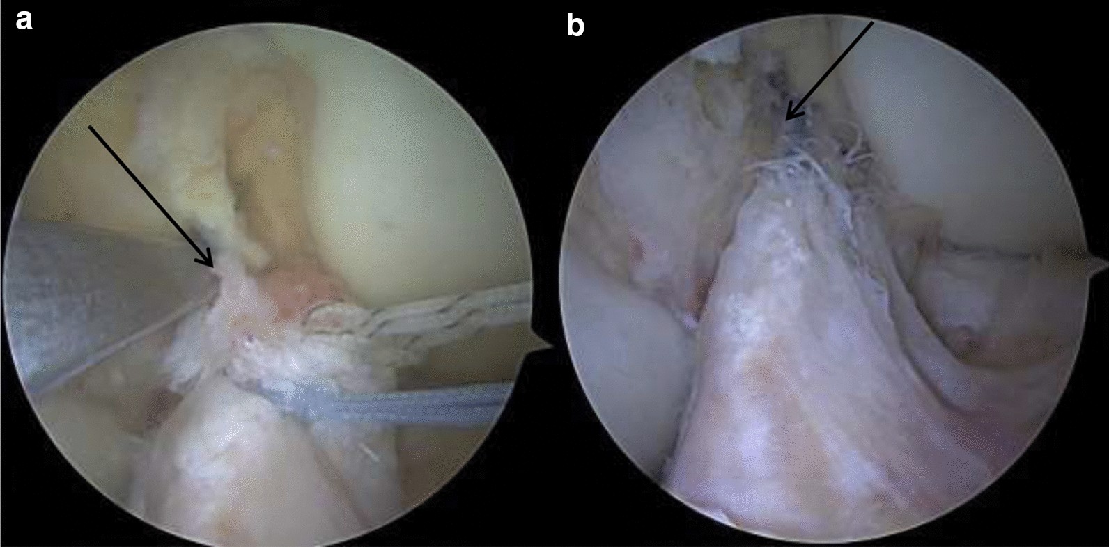 Fig. 1