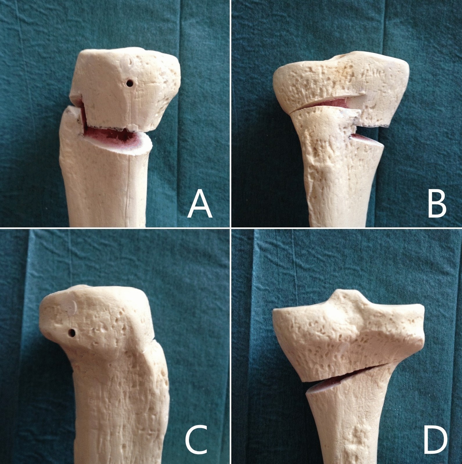 Fig. 1