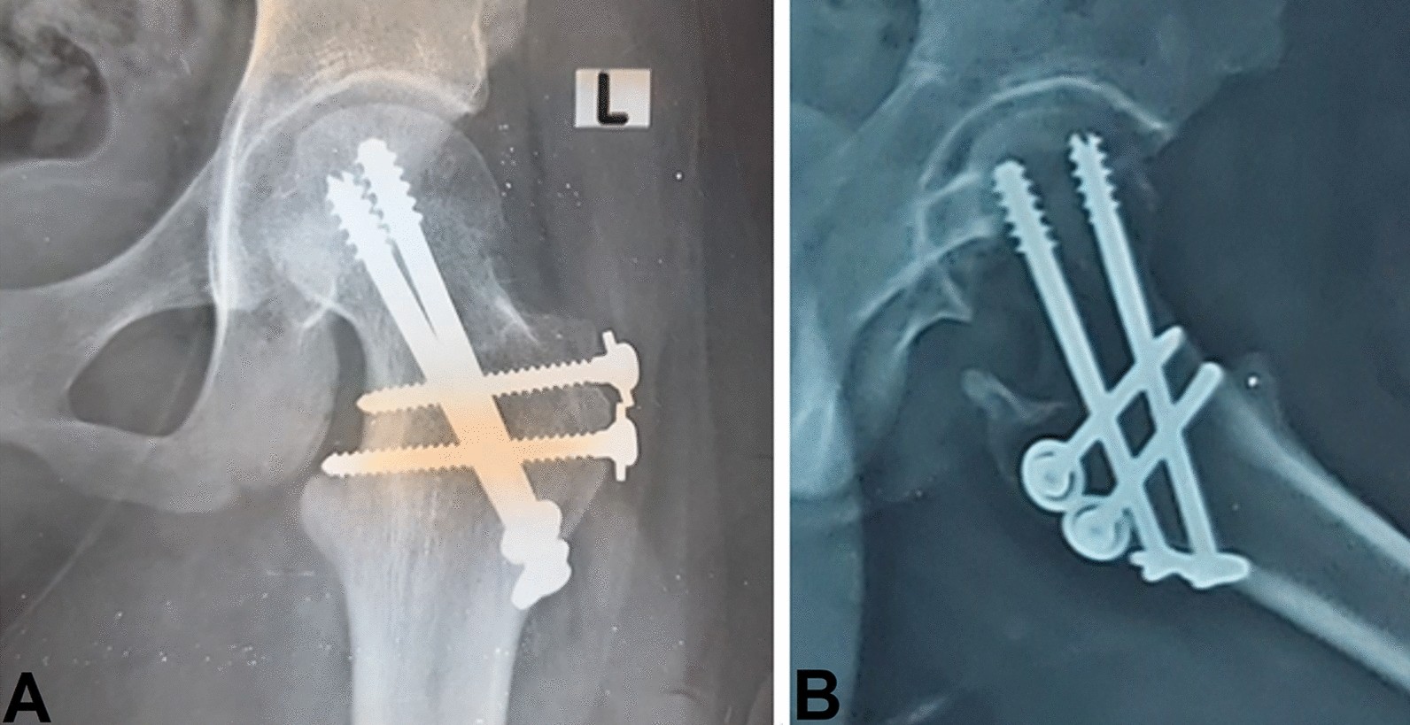 Fig. 7