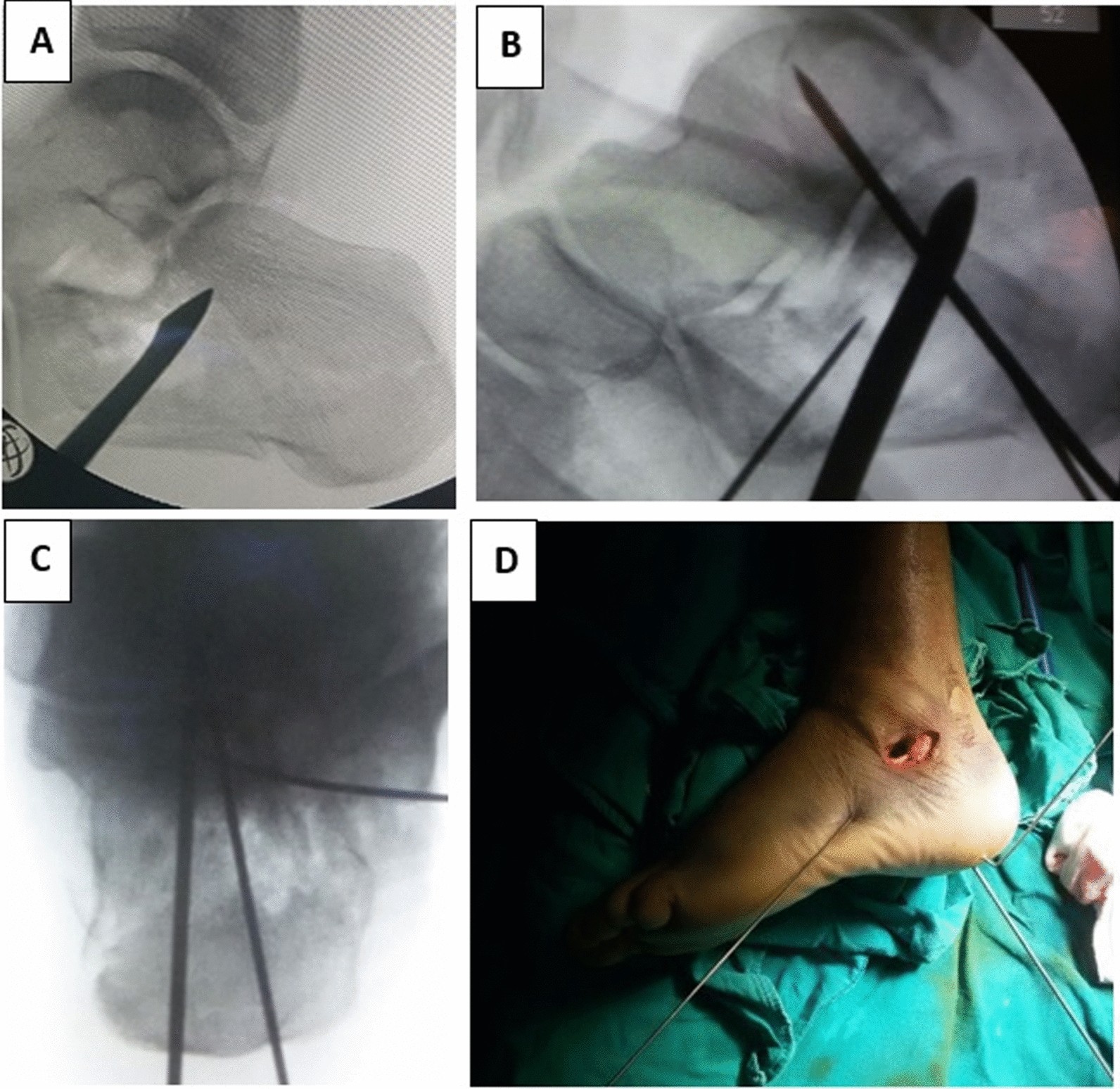 Fig. 2