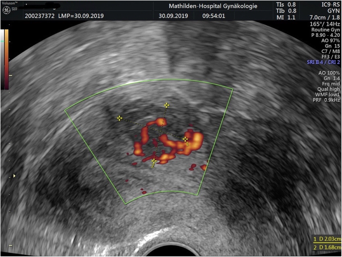 Fig. 2