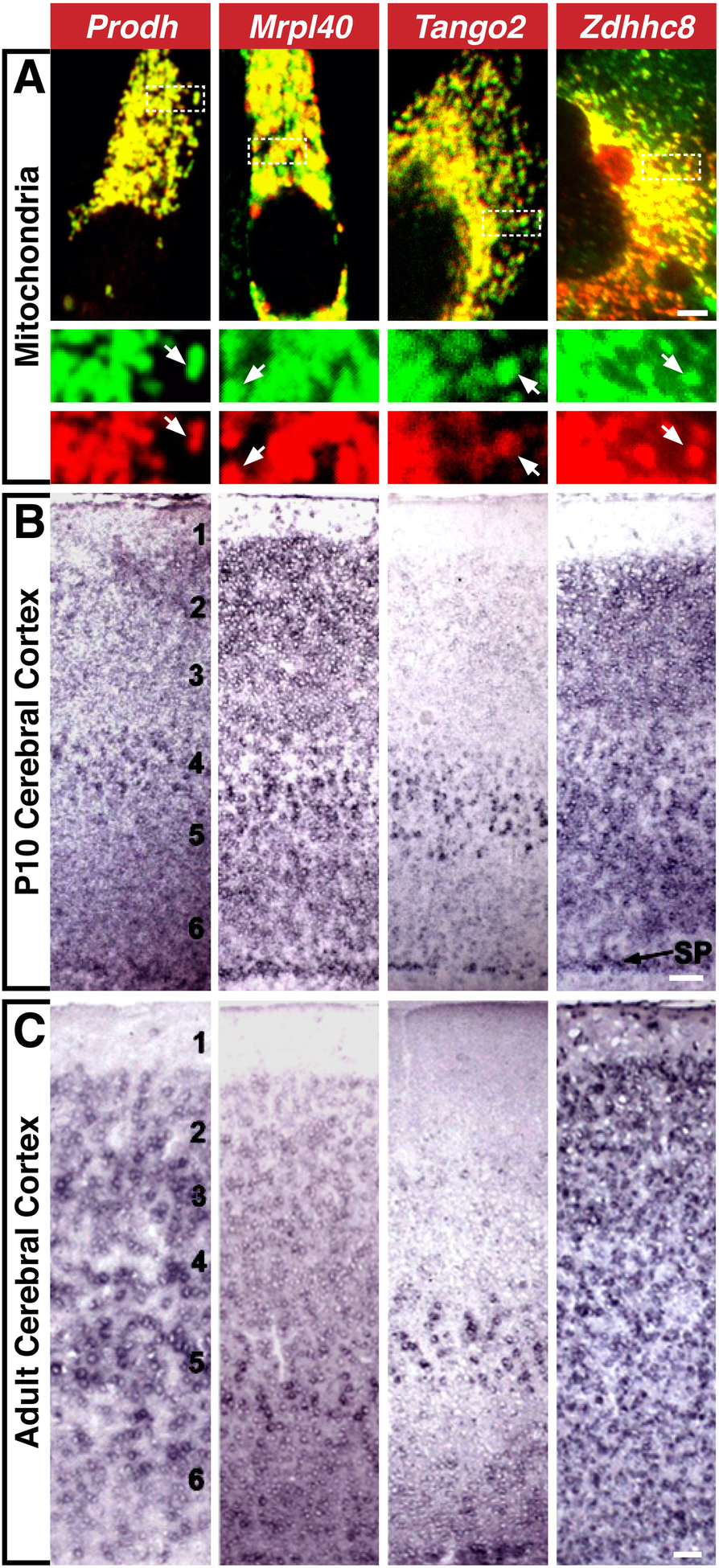 Genes Impact Suspect Cortex Areas More >> In The Line Up Deleted Genes Associated With Digeorge 22q11 2 Genes Impact Suspect Cortex Areas More >> In The Line Up Deleted Genes Associated With Digeorge 22q11 2