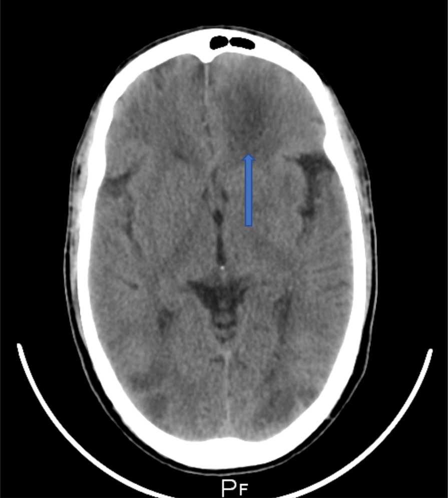 Fig. 14