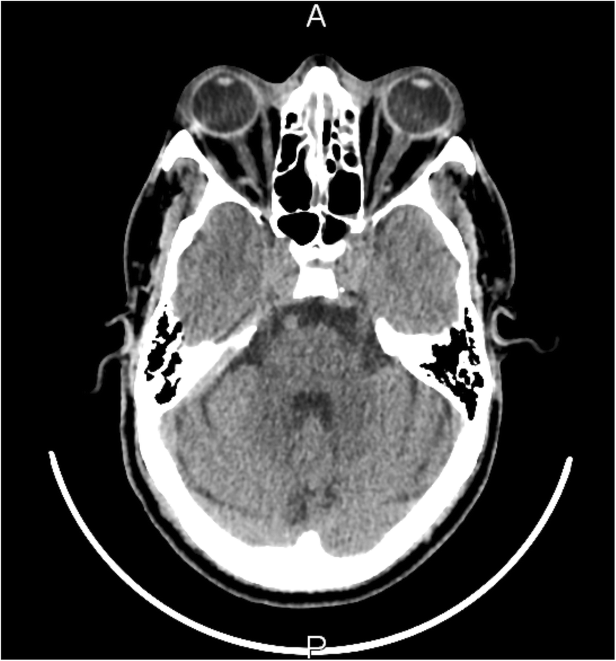 Fig. 7