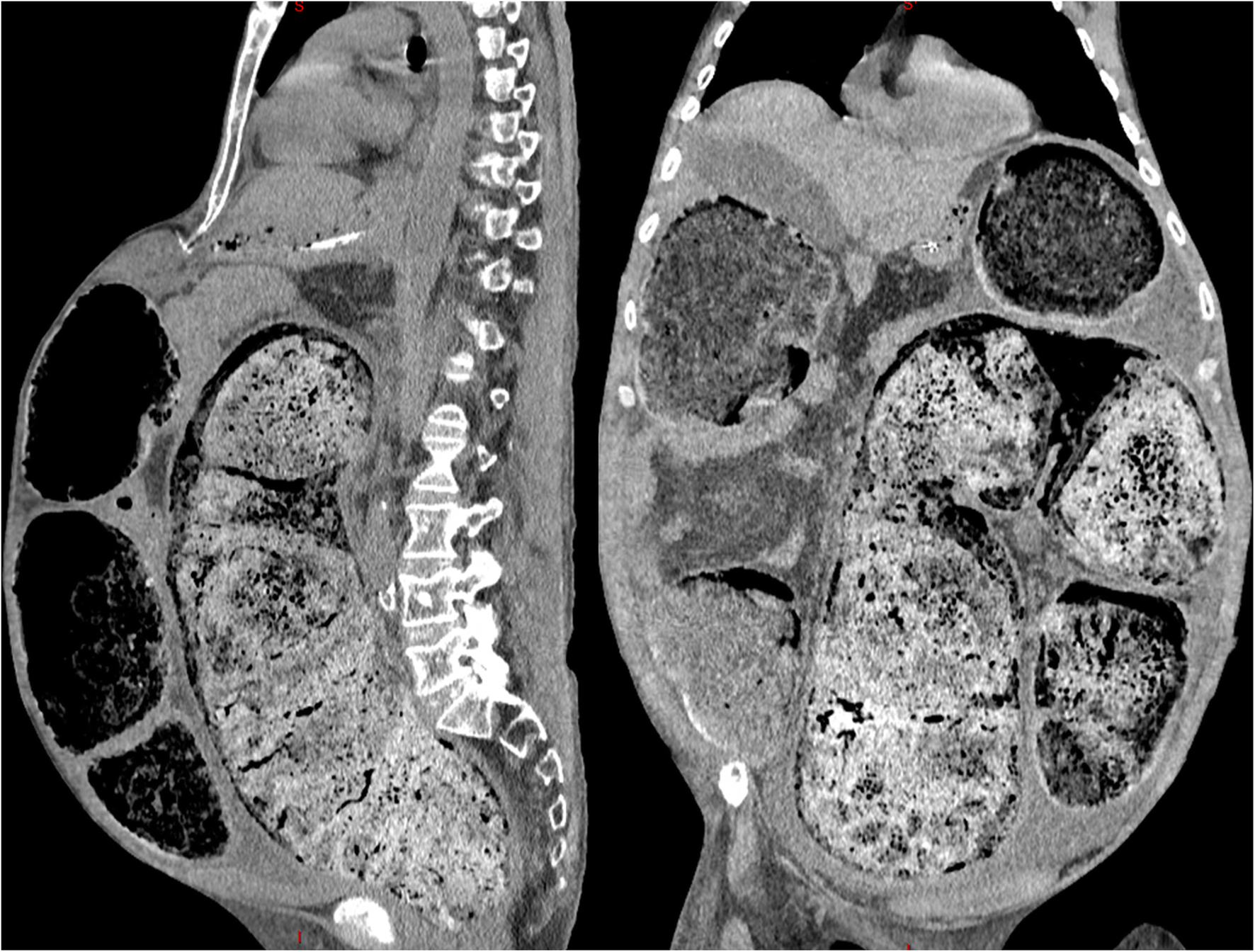 Fig. 2