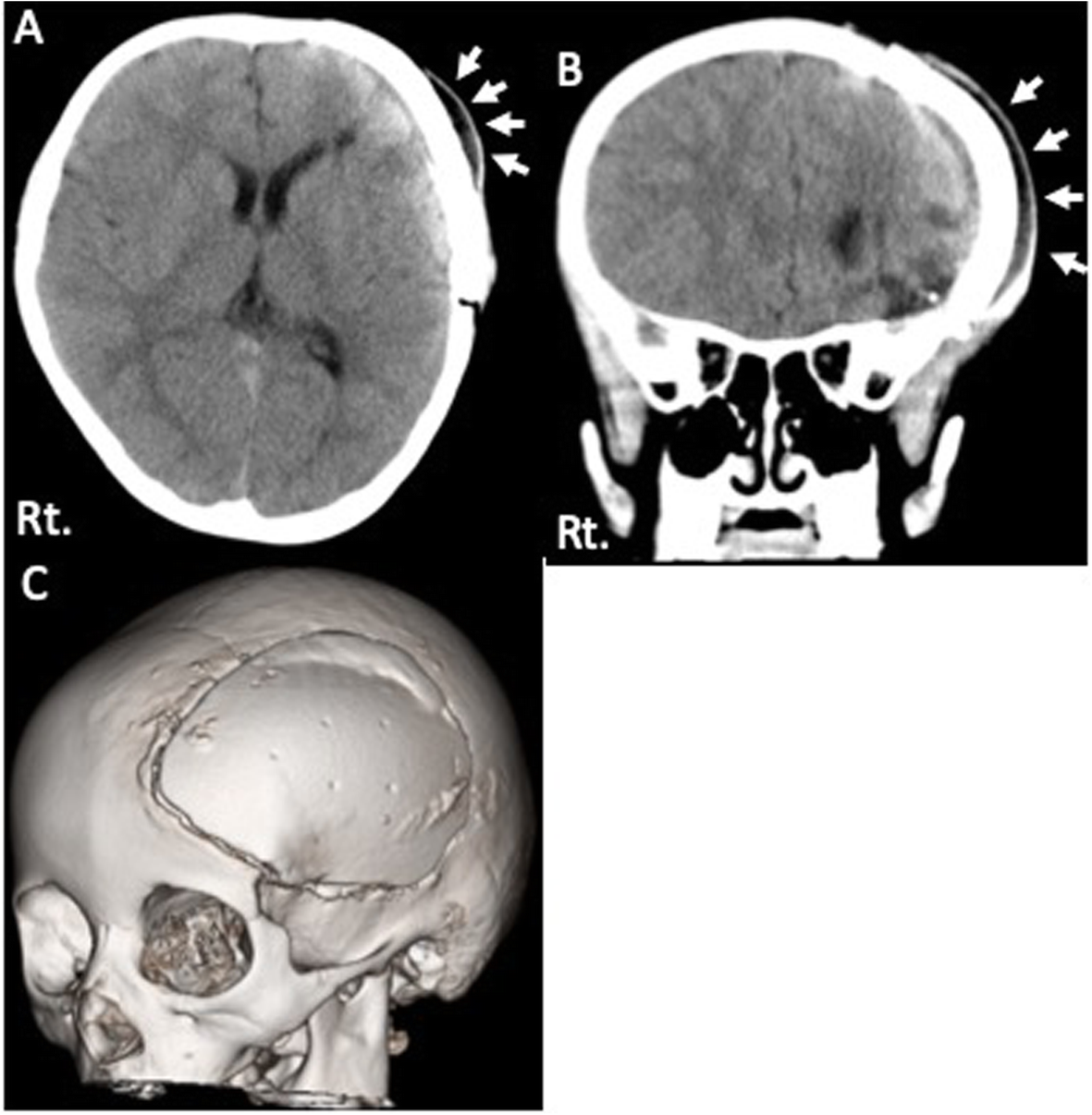 Fig. 2