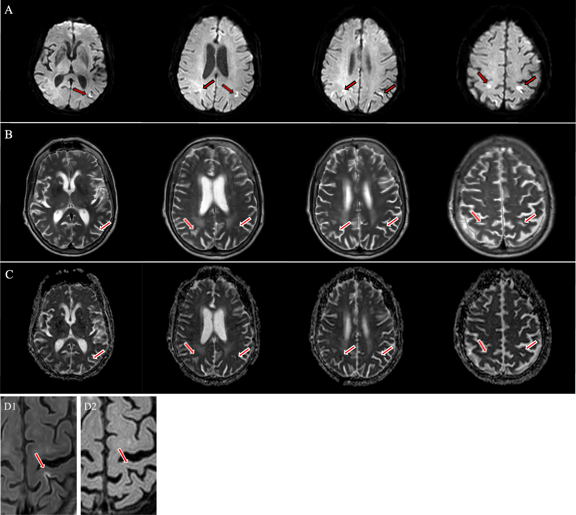 Fig. 2