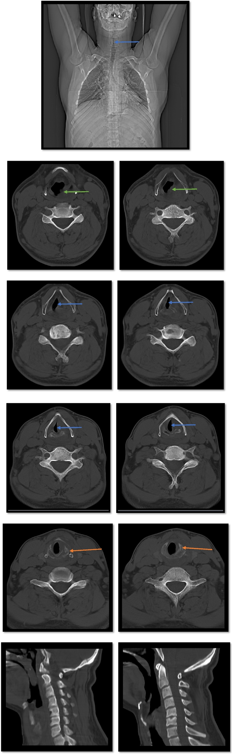 Fig. 3