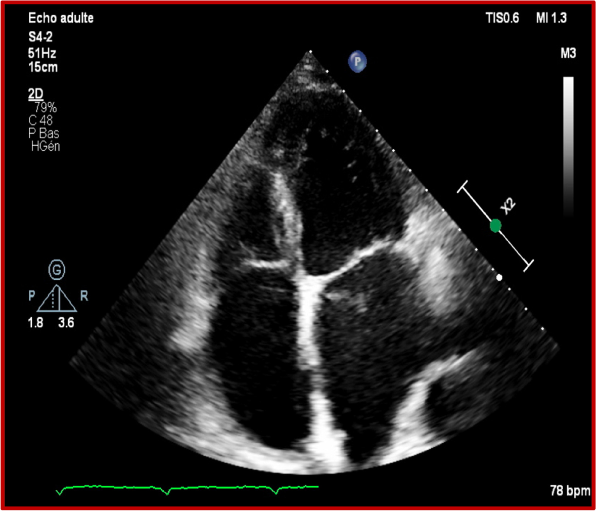 Fig. 5