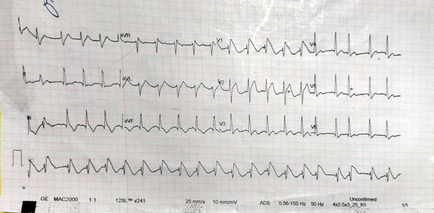 Fig. 1