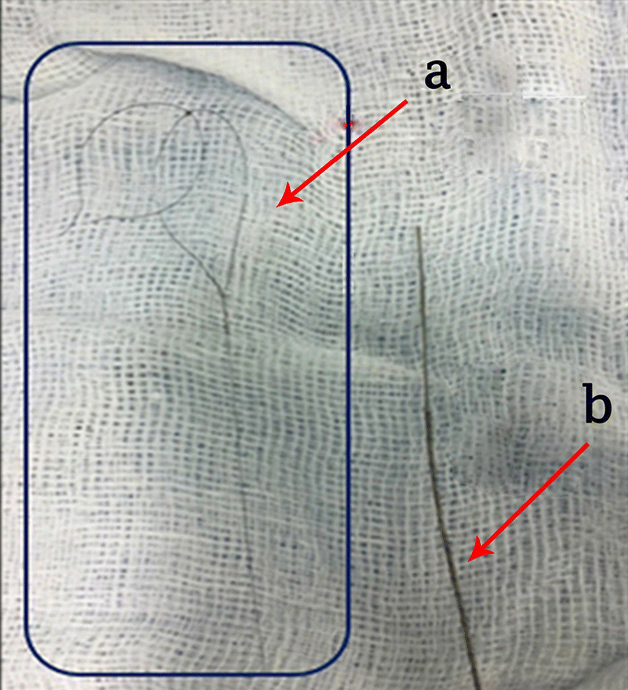 Fig. 2