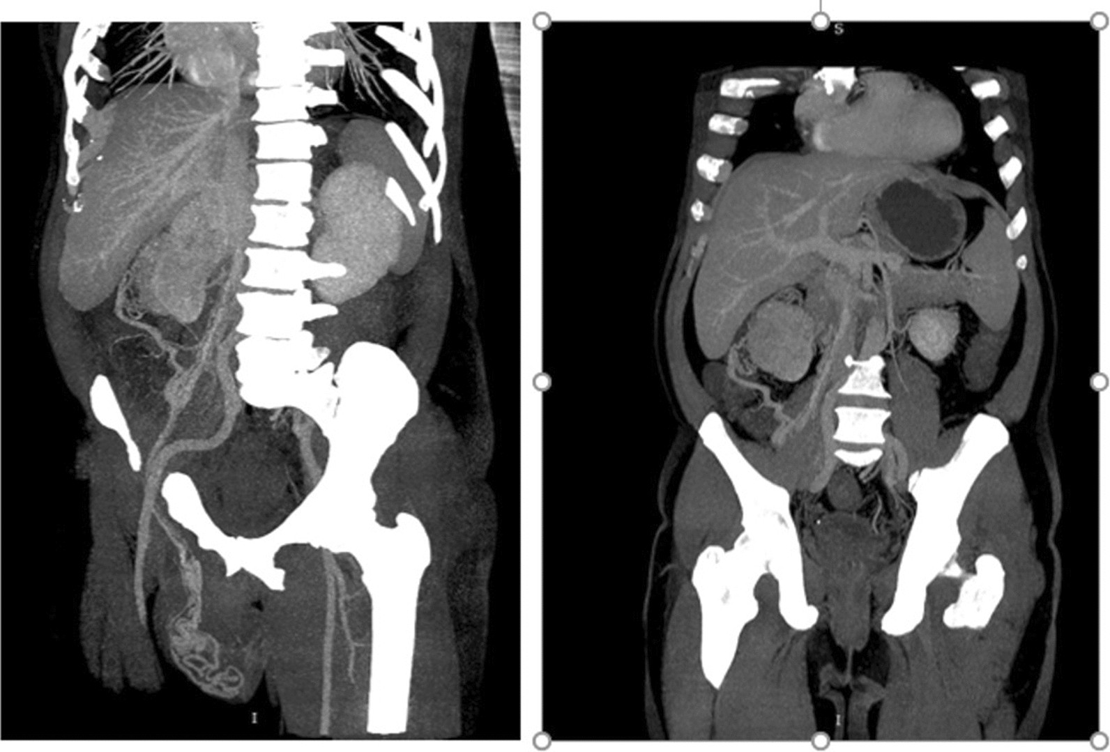 Fig. 3