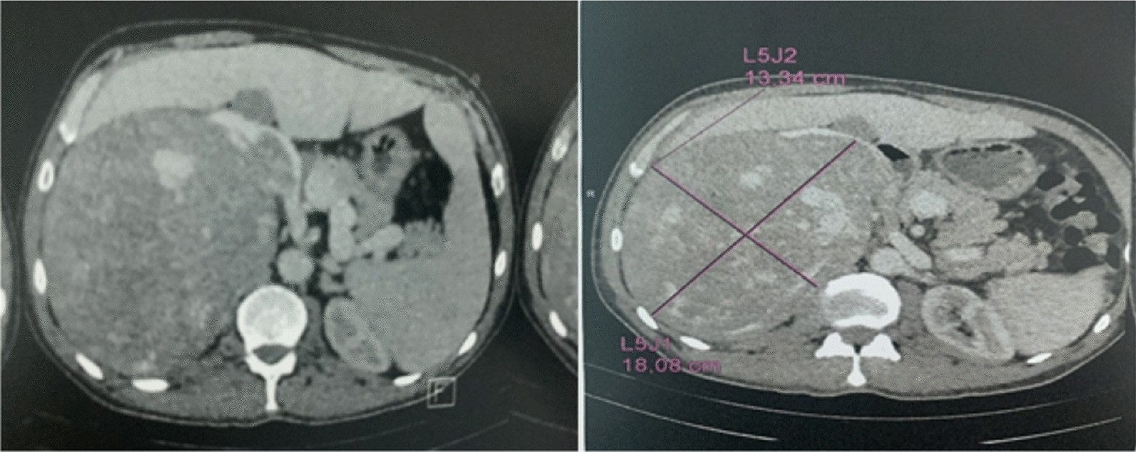 Fig. 2