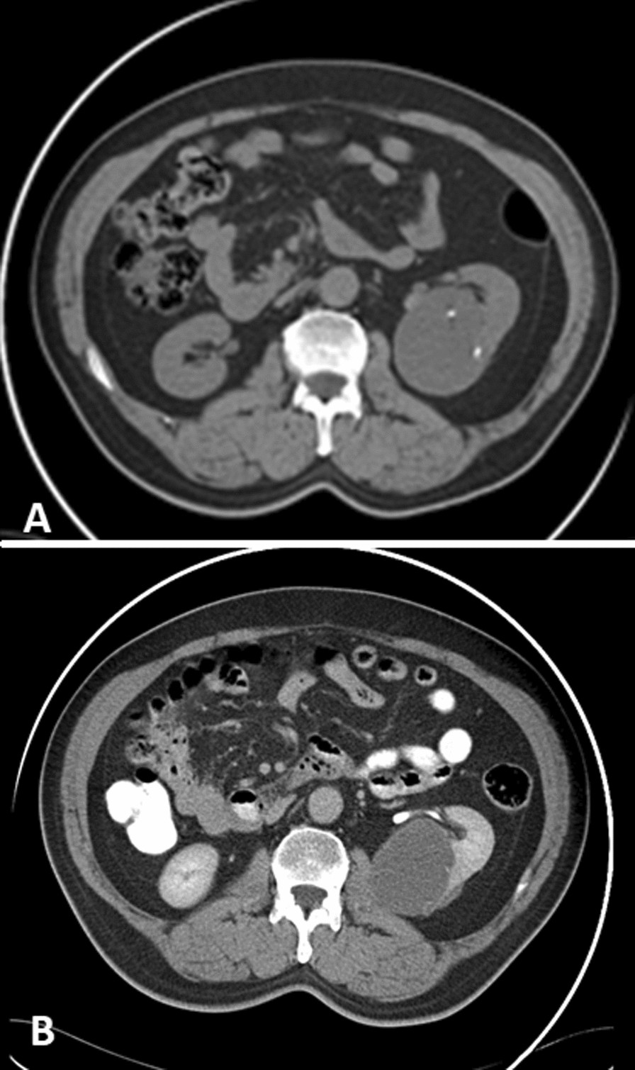 Fig. 1