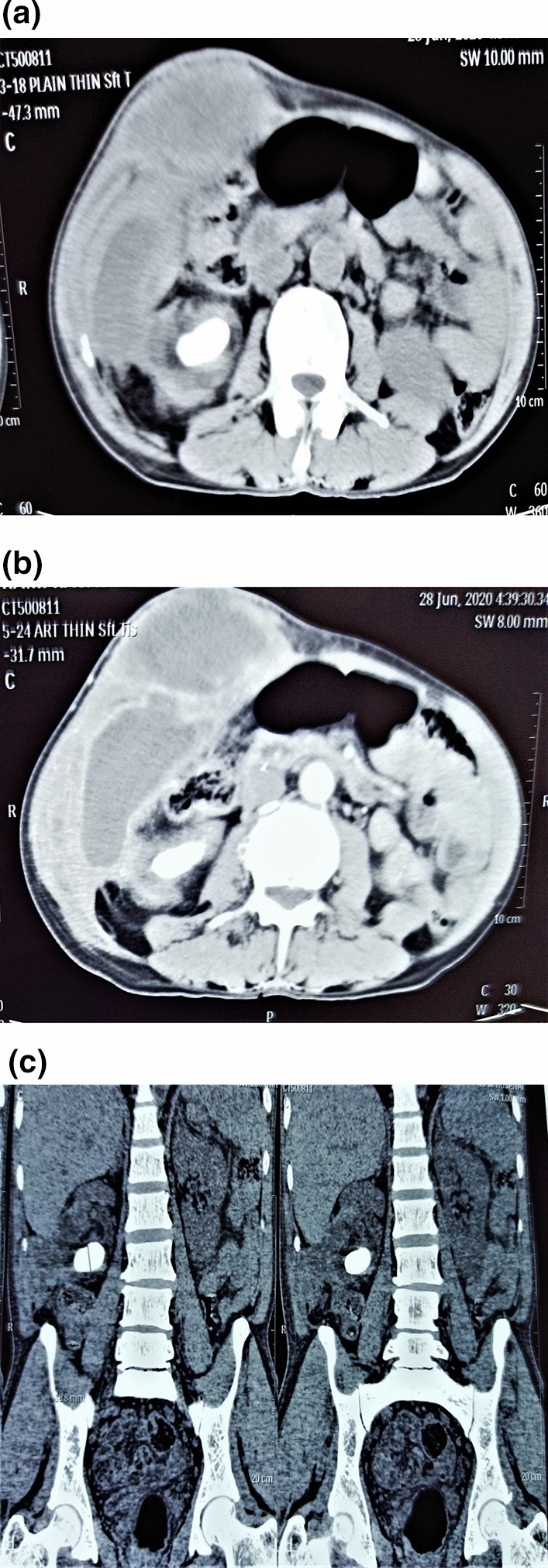 Fig. 2