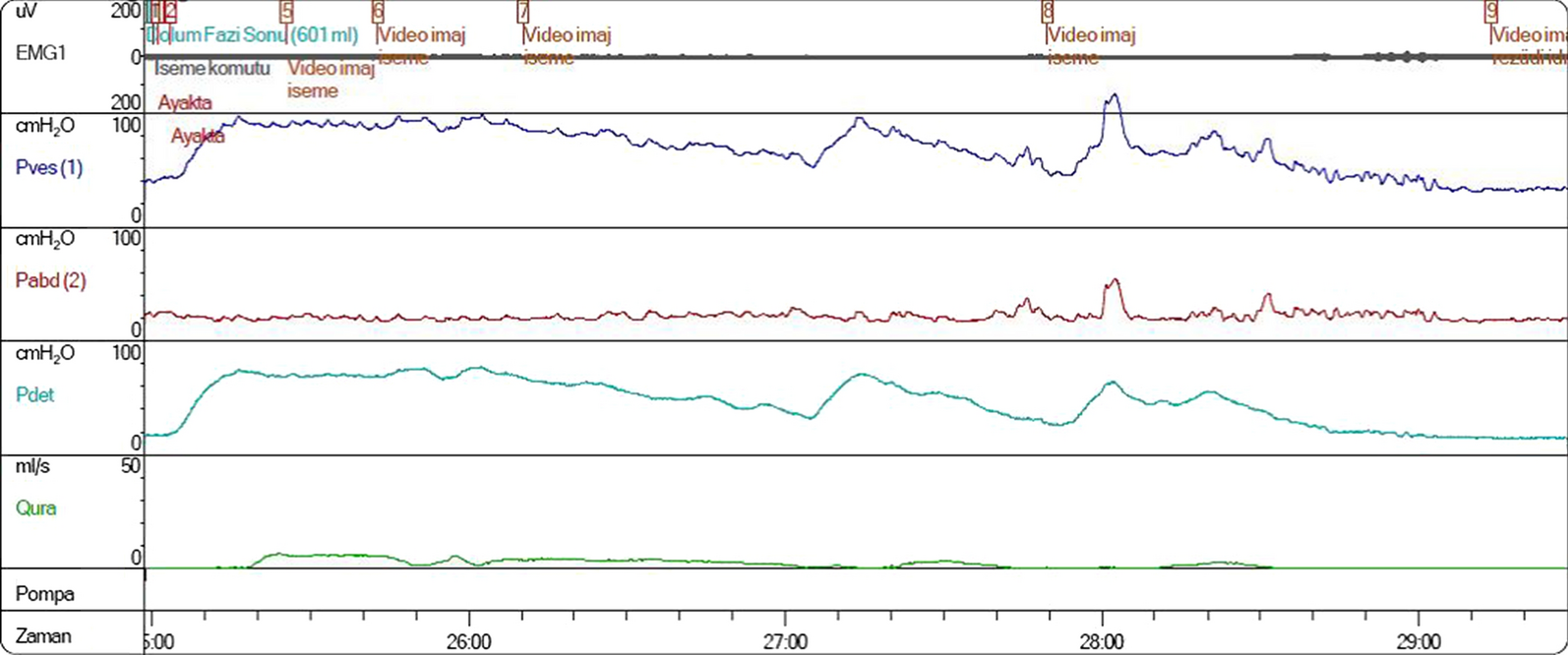 Fig.1