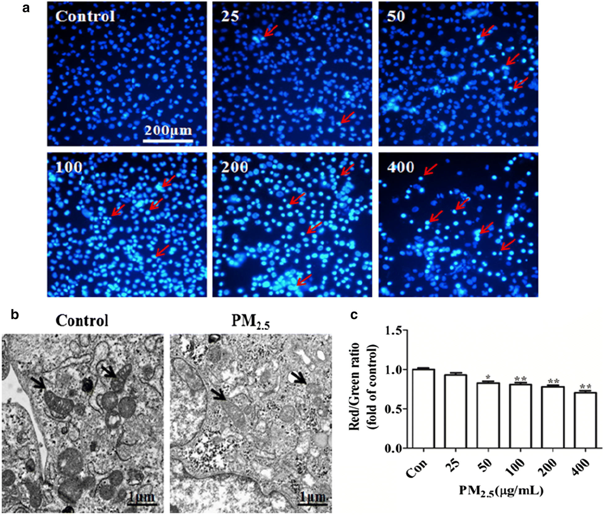 The activation of antioxidant and apoptosis pathways involved in damage of  human proximal tubule epithelial cells by PM2.5 exposure | Environmental  Sciences Europe | Full Text