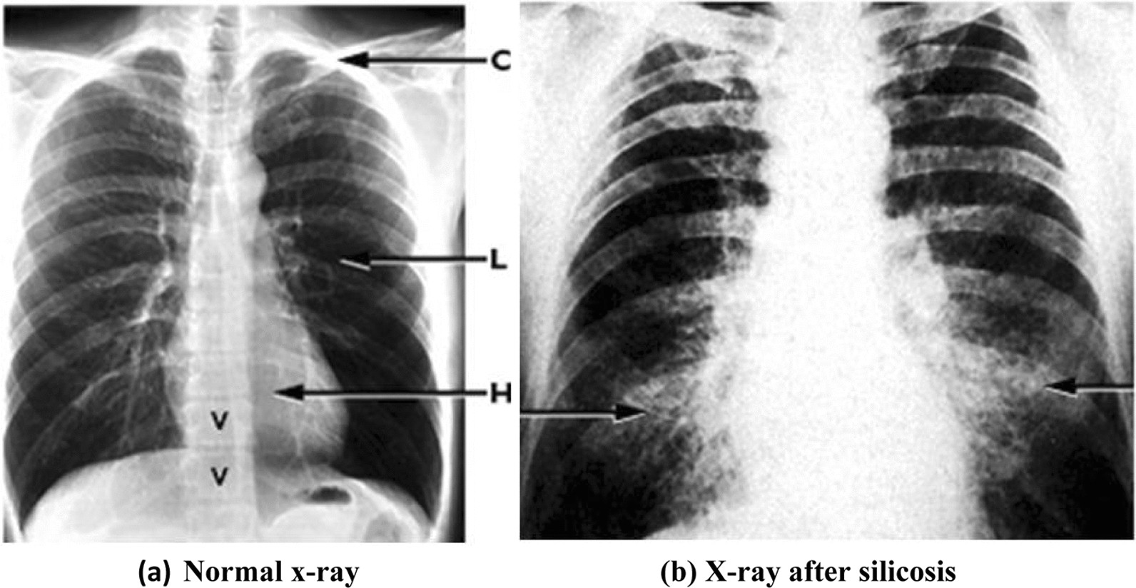 Fig. 14