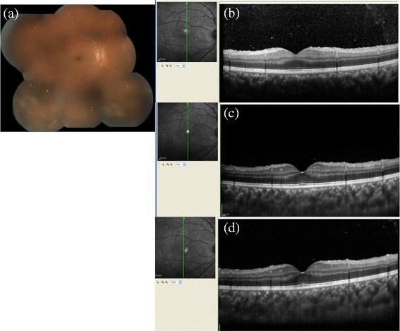 Figure 9