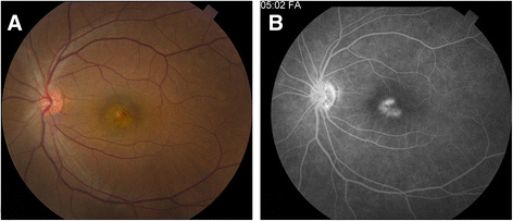 Fig. 1