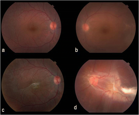 Fig. 1