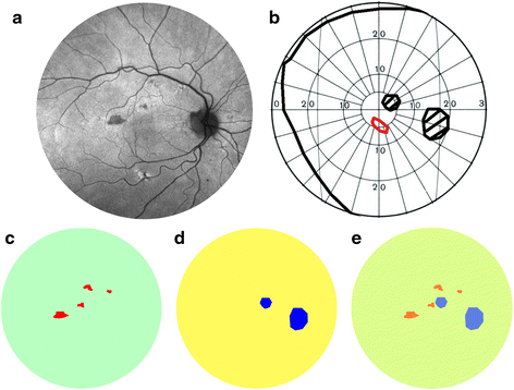 Fig. 1