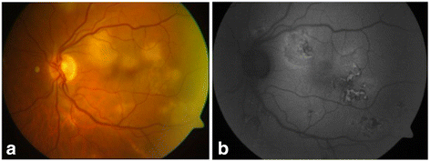 Fig. 2