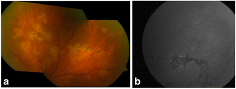 Fig. 4