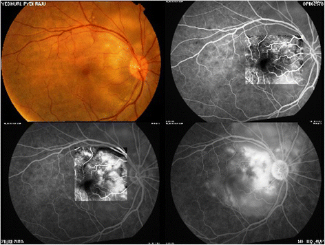 Fig. 2