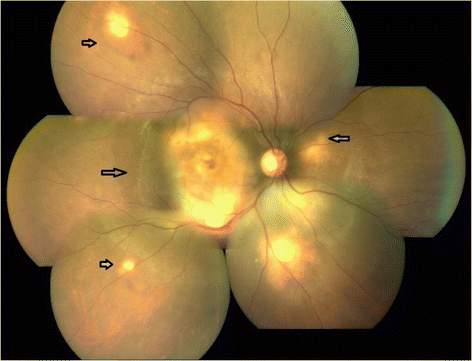 Fig. 1