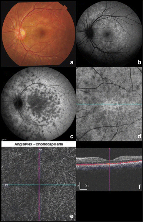 Fig. 6