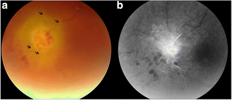 Fig. 1