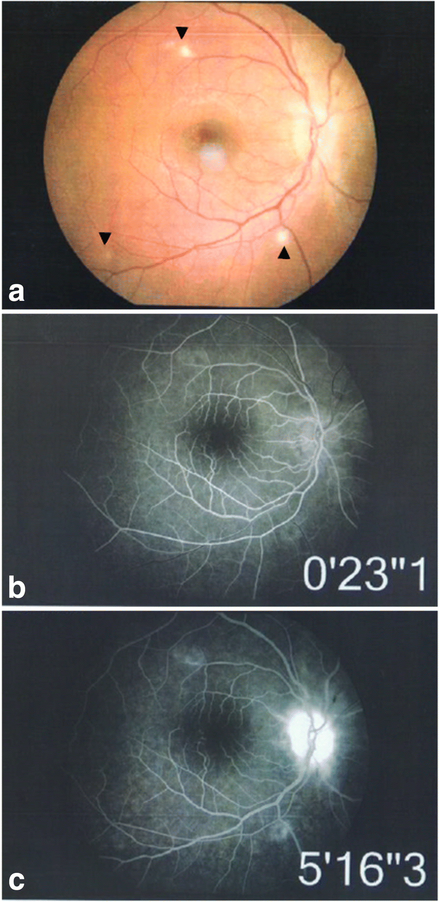 Fig. 3