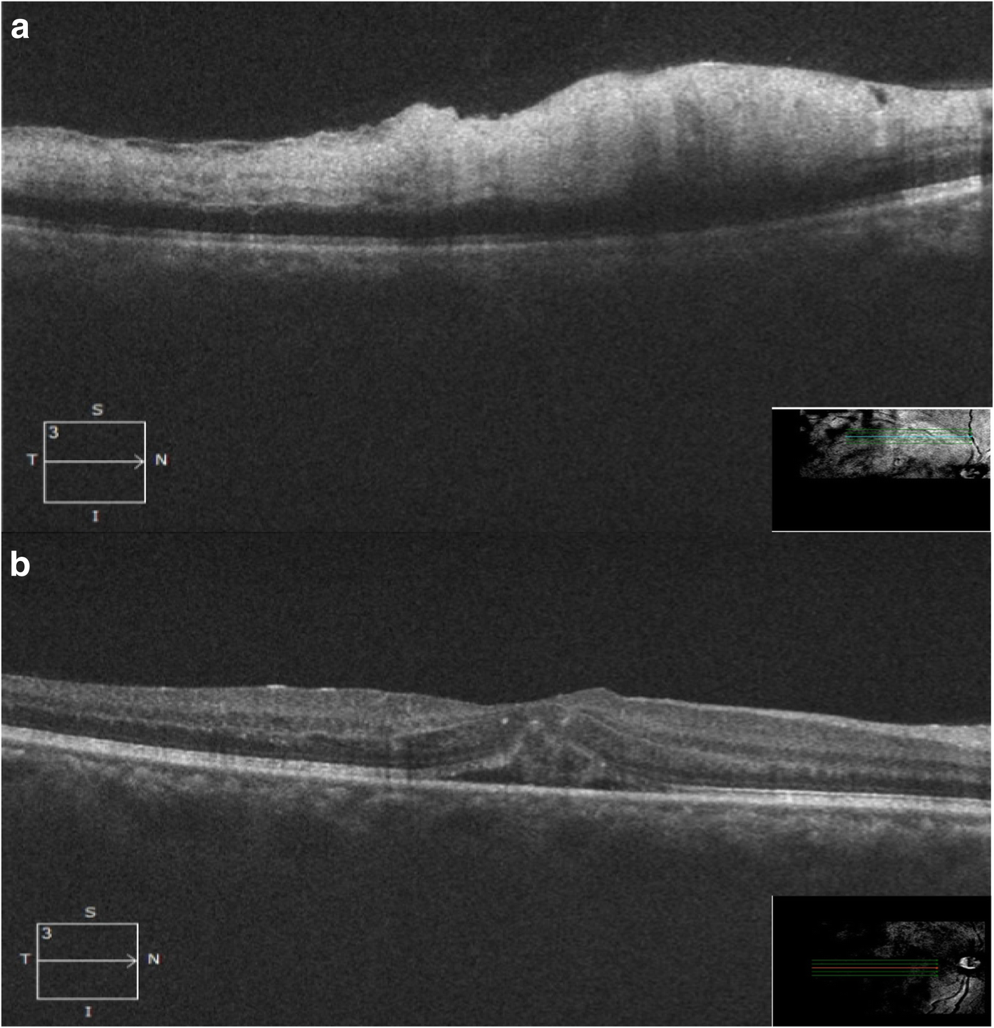 Fig. 2